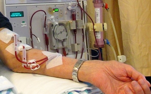 Séance d'hémodialyse
